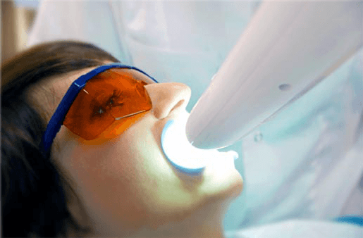 Understanding the Causes of Teeth Sensitivity Luton