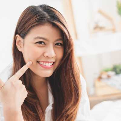 laser teeth whitening