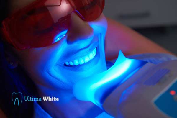 Professional Teeth Whitening Options Luton