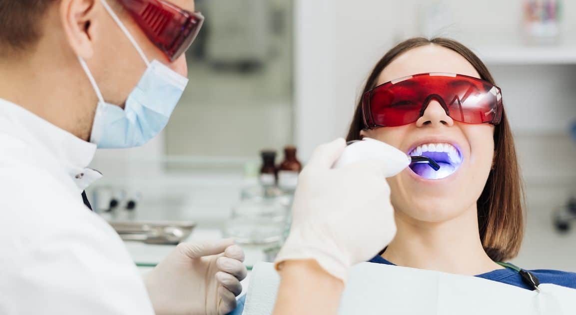 Do Dental Crowns Change Colour After Teeth Whitening Luton?