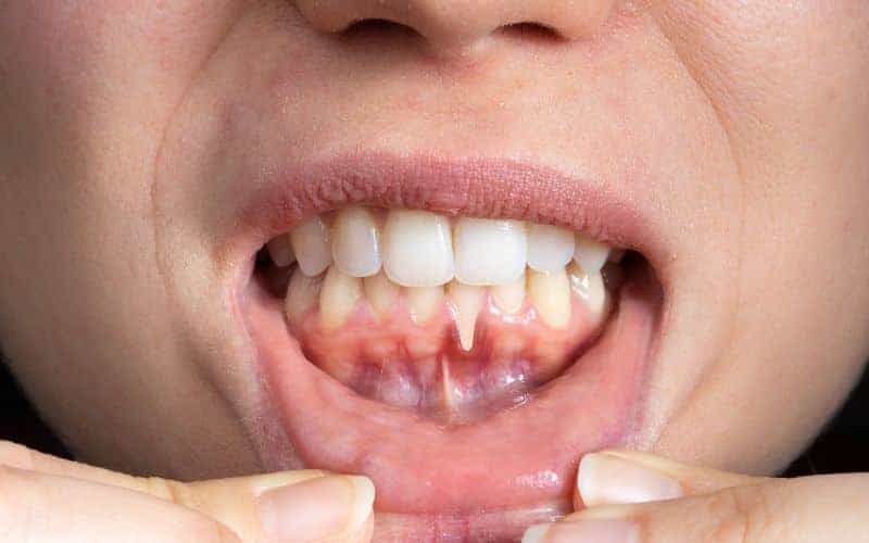Final Thoughts: Building Lifelong Enamel Protection Habits Luton