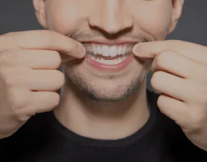 Overview of Home Teeth Whitening Kits Luton