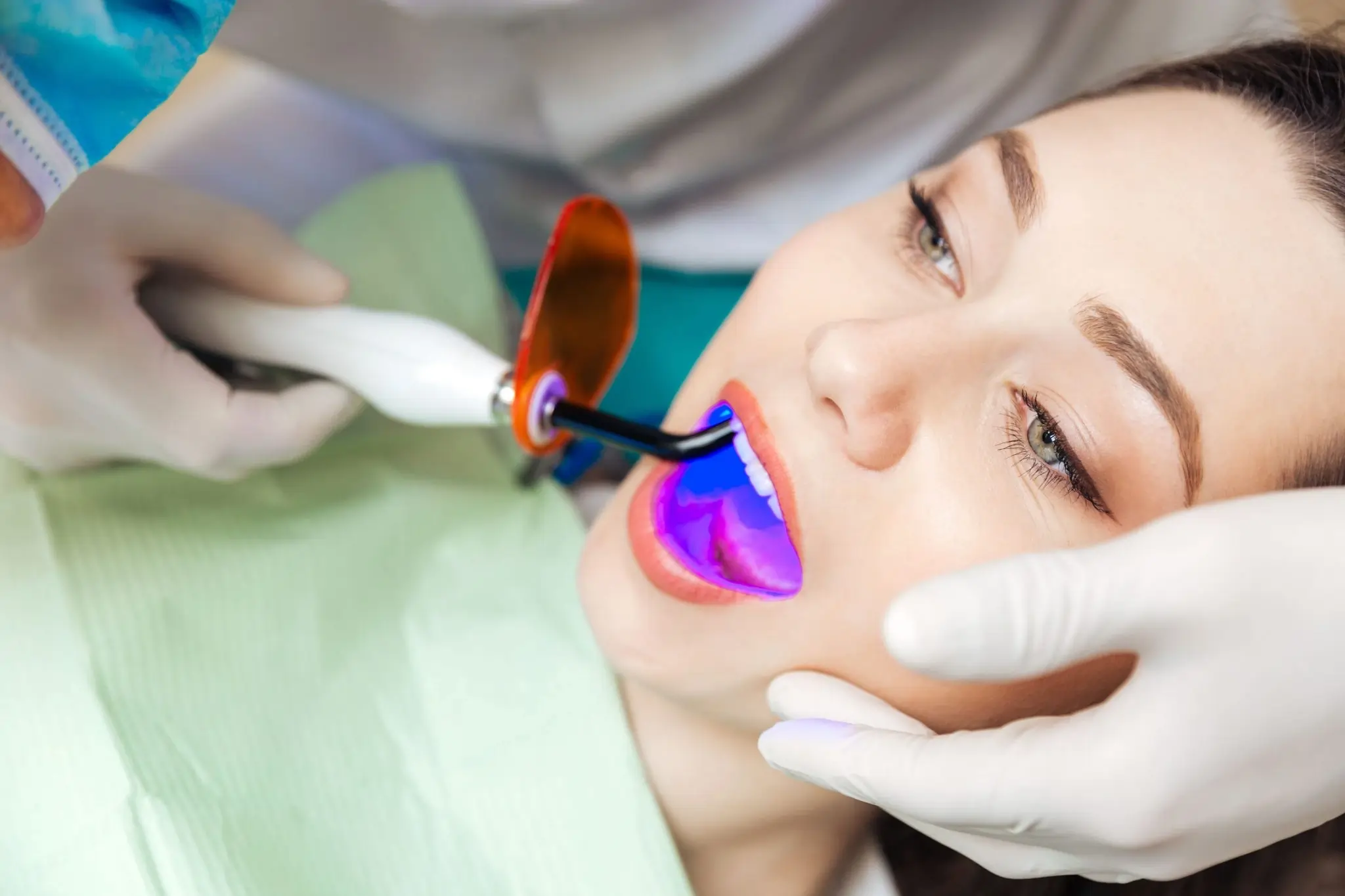 Common Risks of Whitening Without Expert Dental Guidance Luton