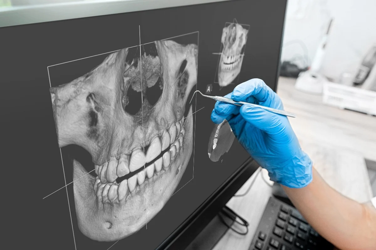 Key Benefits of 3D Printing for Patients and Dentists Luton
