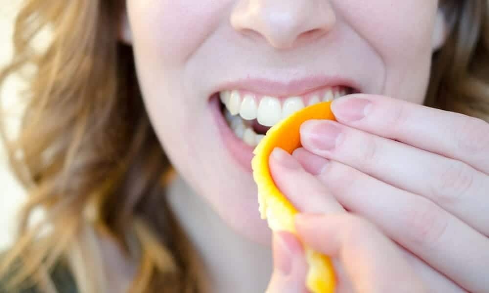 How Long Does Natural Teeth Whitening Take to Show Results Luton?