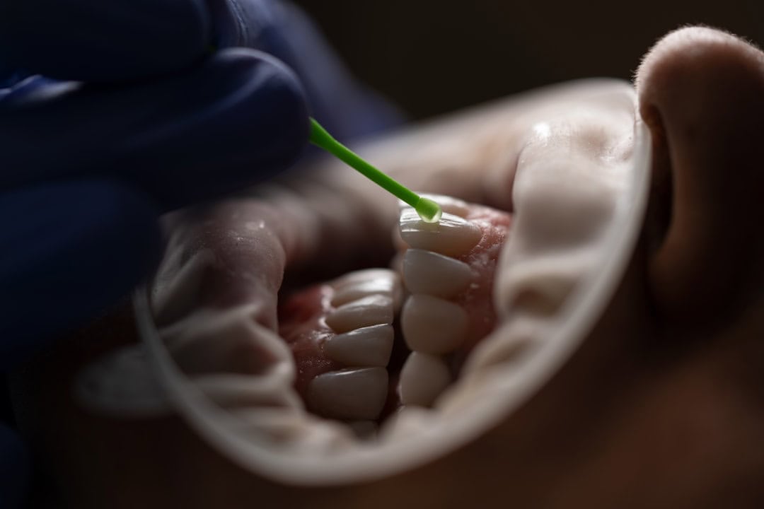 How Saliva Protects Your Teeth and Gums Luton