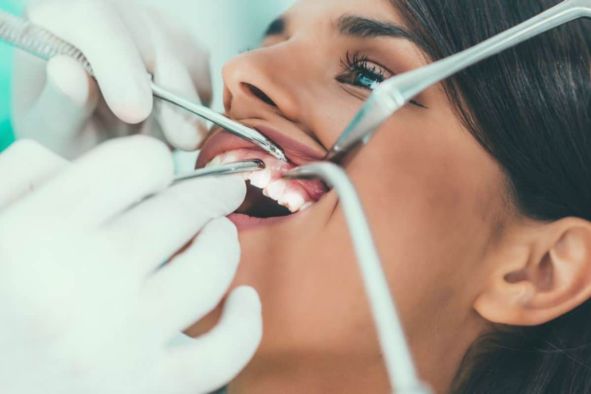 Can Laser Whitening Damage Your Enamel or Cause Long-Term Harm Luton?