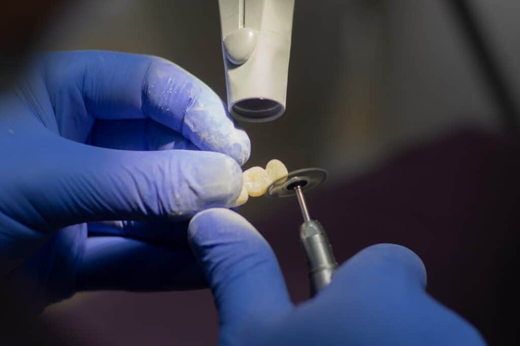 Customised Dental Solutions: Crowns, Aligners, and Implants Luton