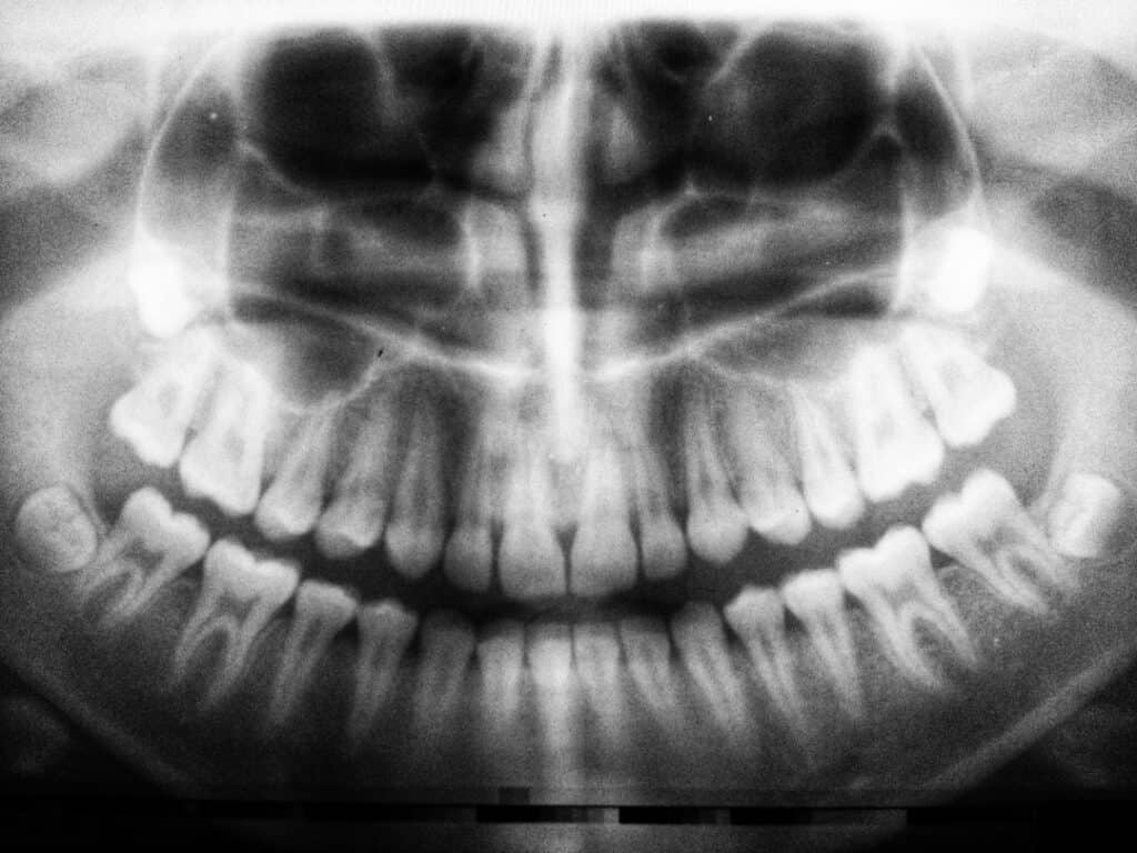 The Future of 3D Printing in Oral Healthcare Luton