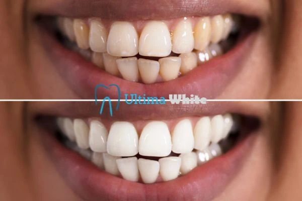 Long lasting results from Ultima White Luton